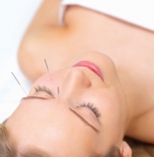 Photo showing facial acupuncture.